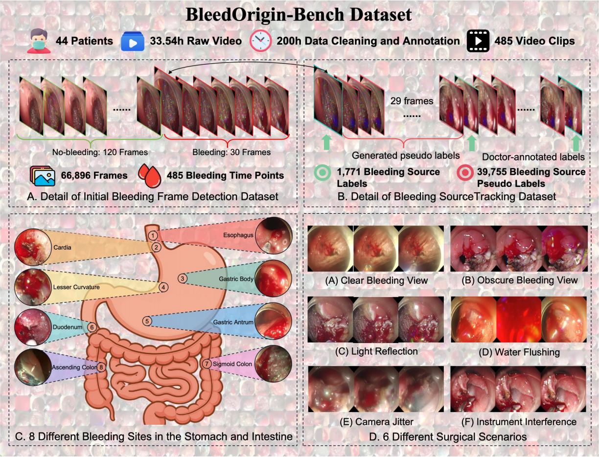 BleedOrigin-Bench Dataset Overview